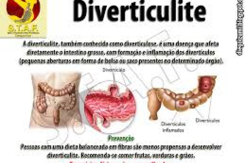 Dieta para diverticulite conheça os alimentos permitidos e quais evitar ATLÂNTICA News