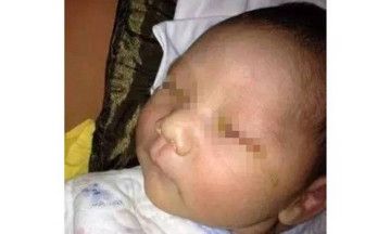 Foto: