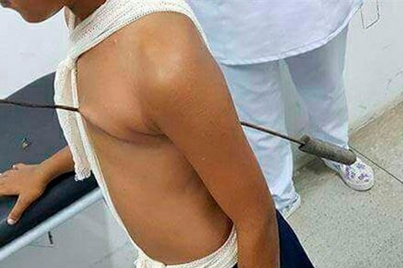 Foto: